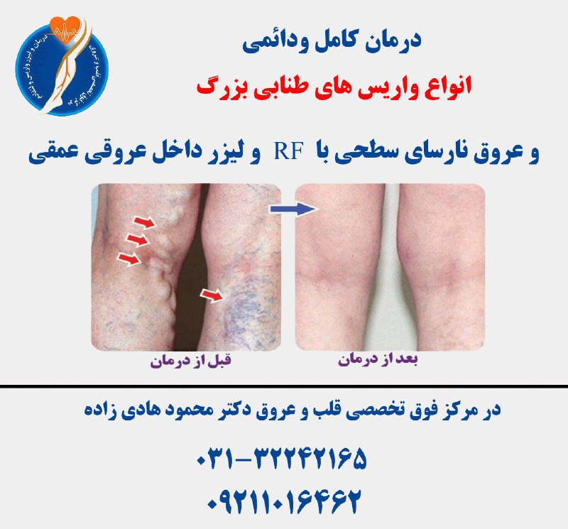 بهترین متخصص واریس ایران