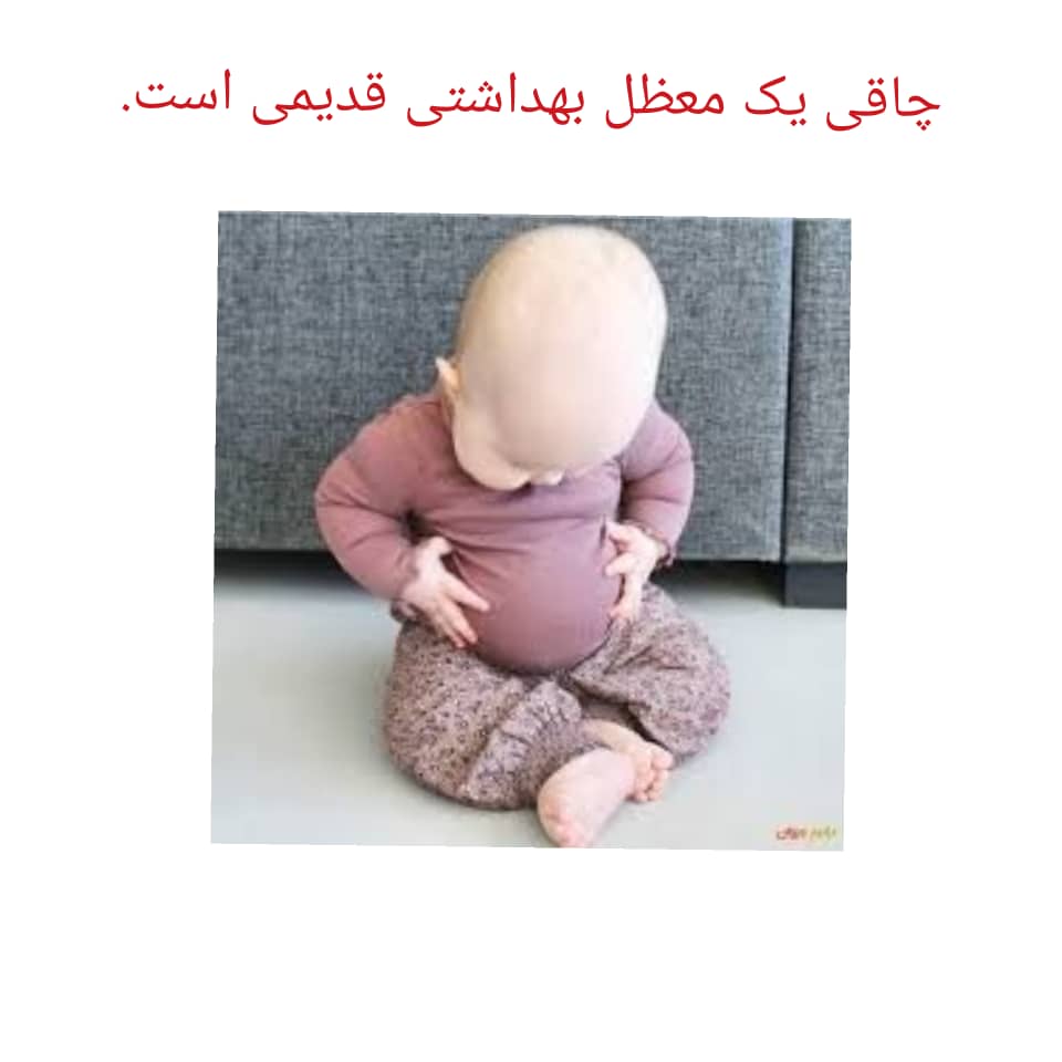 درمان چاقی